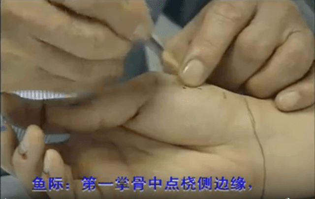 针灸真人配穴取穴